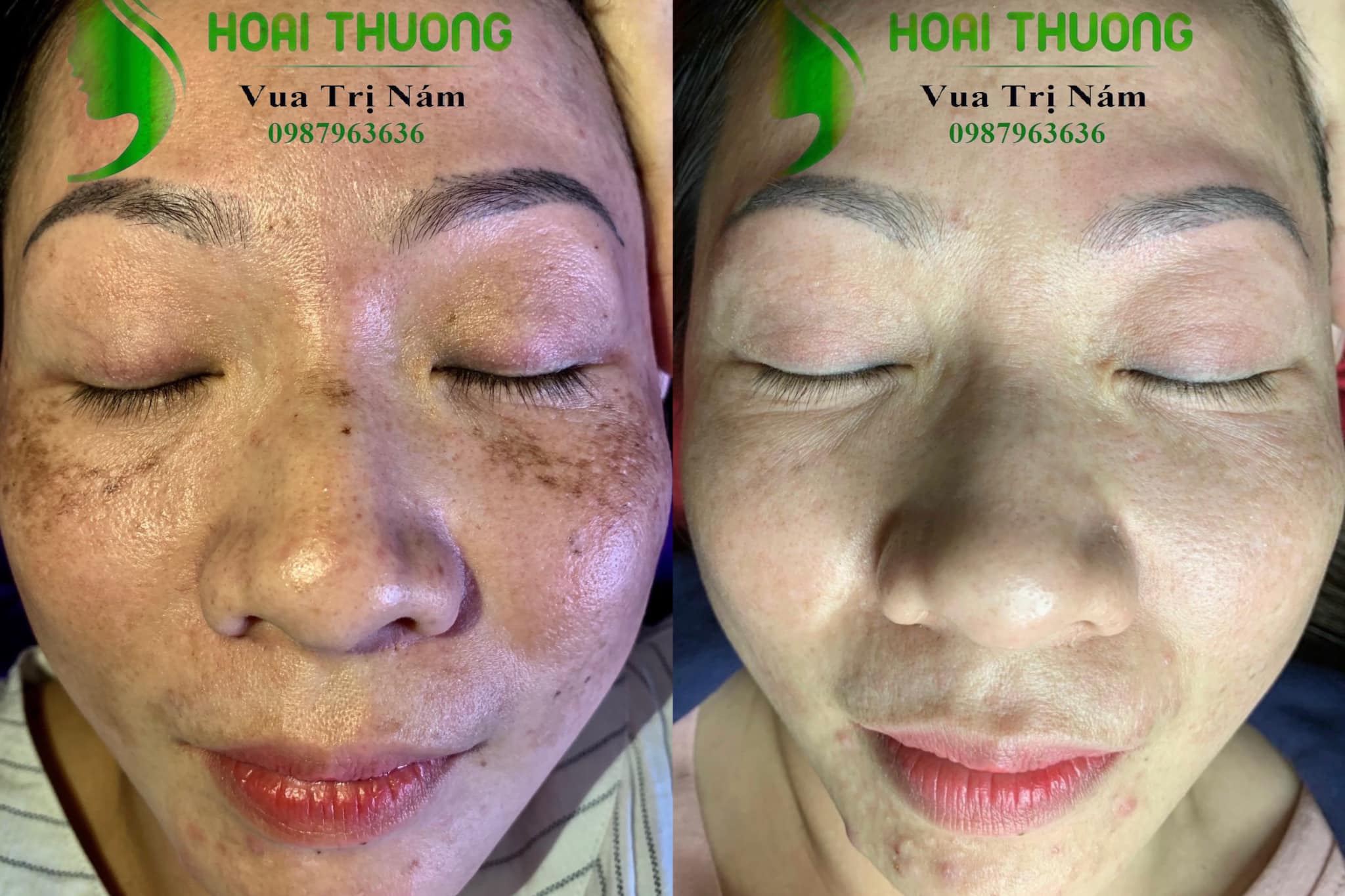 Hoài Thương Spa ảnh 1