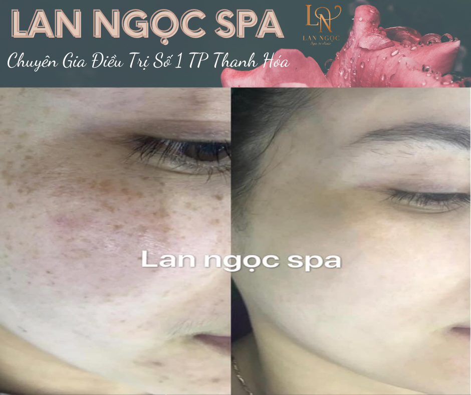 Lan Ngọc Spa ảnh 1