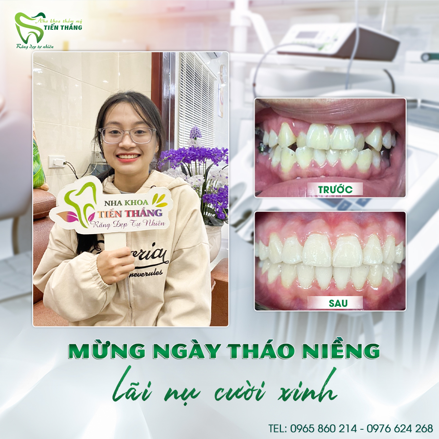 NHA KHOA TIẾN THẮNG ảnh 2