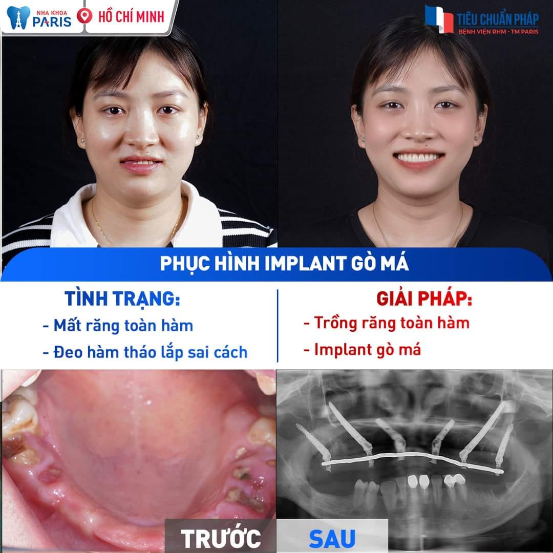 Nha Khoa Paris Buôn Ma Thuột ảnh 2