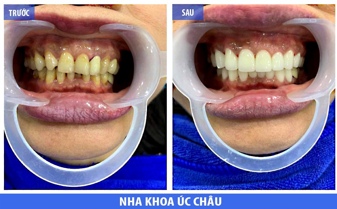 Nha Khoa Úc Châu ảnh 1