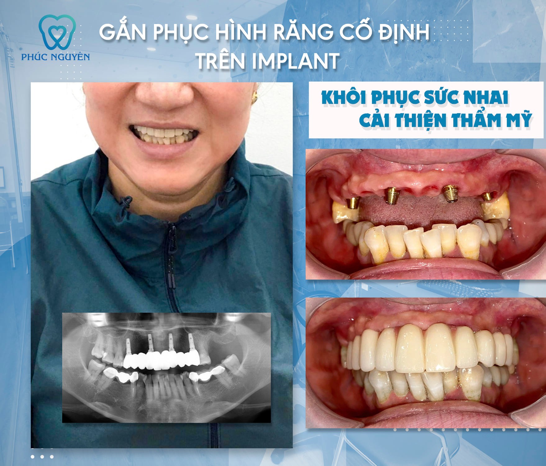 Nha khoa Phúc Nguyên ảnh 1