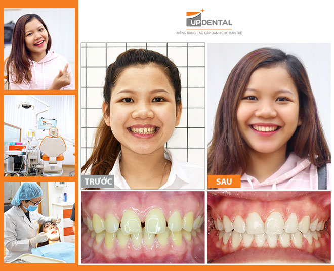 Nha khoa Up Dental ảnh 2