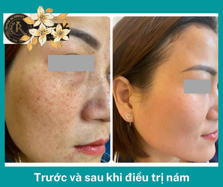 Spa Beauty Royal ảnh 1