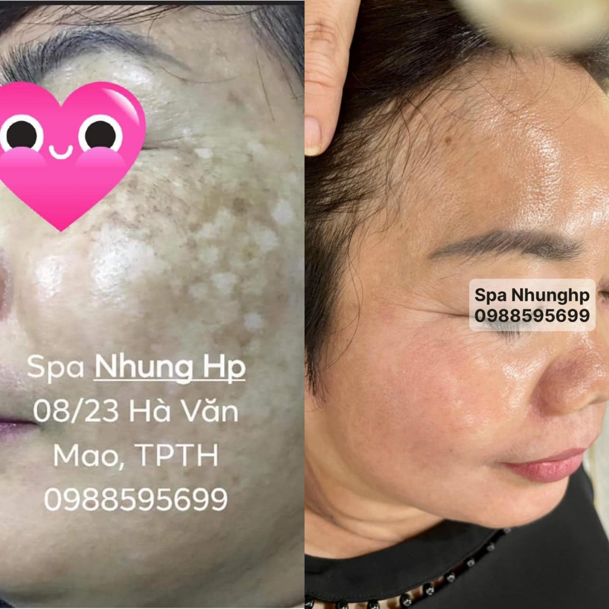 Spa Nhung HP ảnh 1