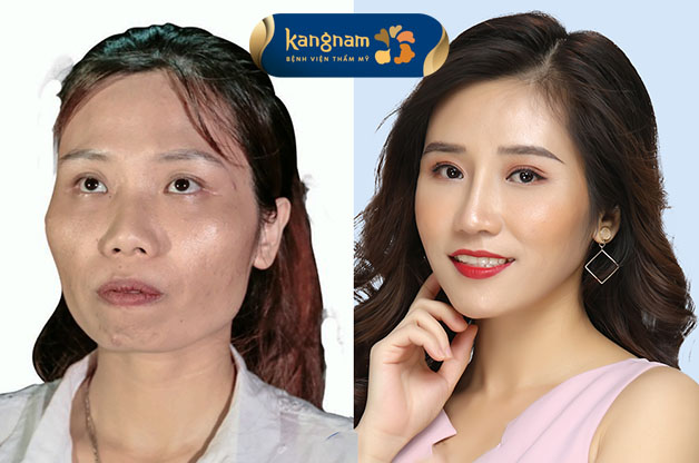 Viện Thẩm mỹ Kangnam Bình Dương ảnh 2