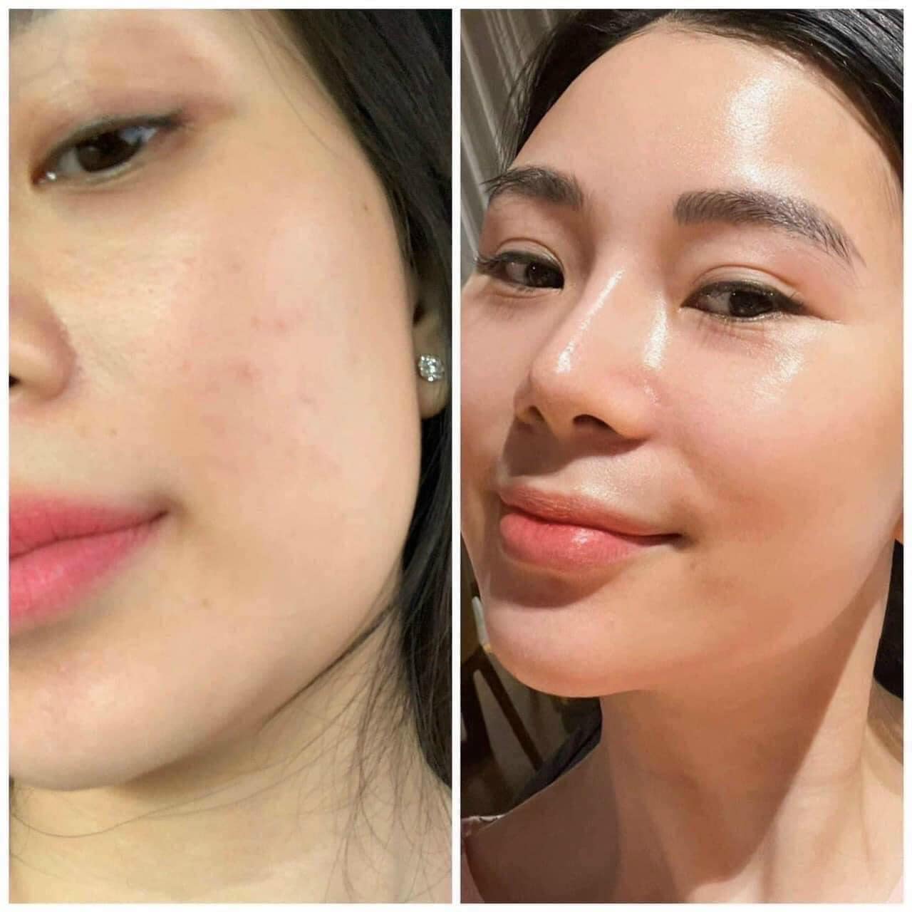 Yên Spa & Skinlab ảnh 2