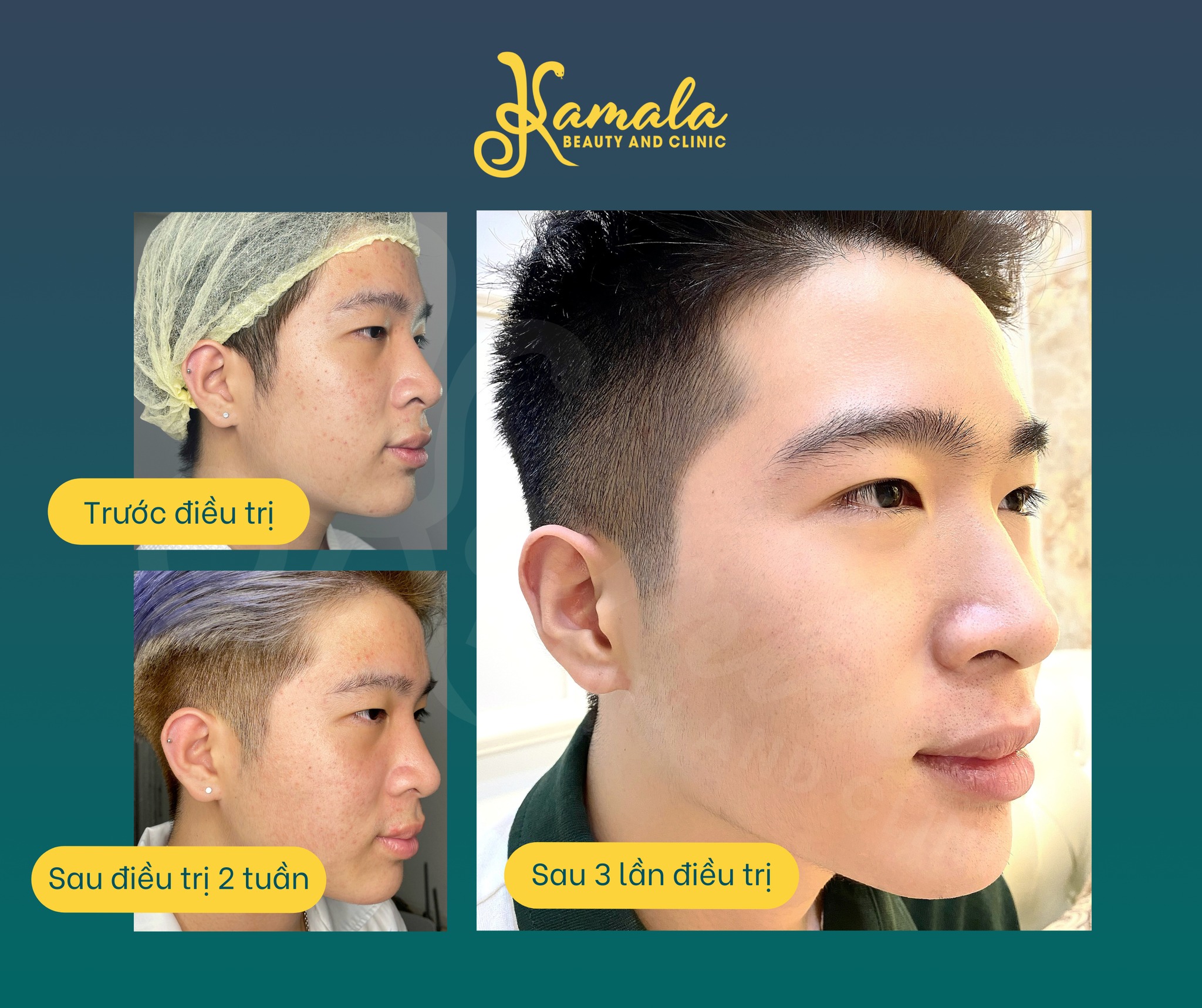 Kamala Beauty & Clinic ảnh 1