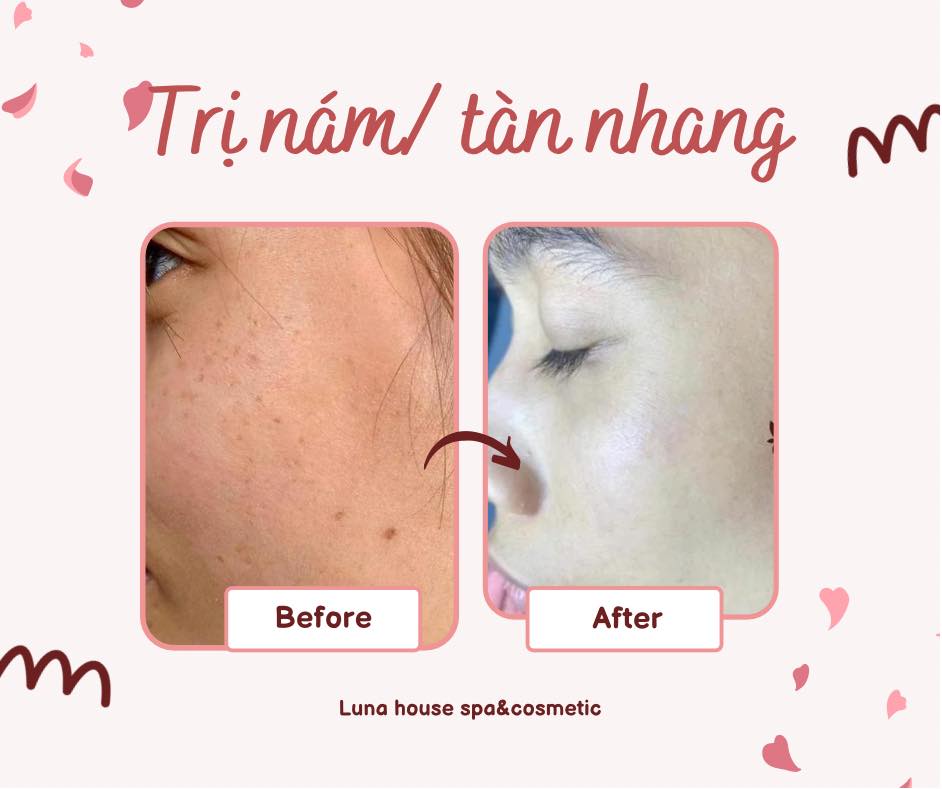 Luna House Spa & Cosmestic ảnh 2