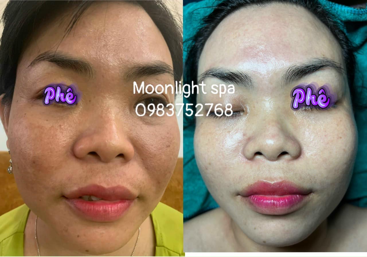 MoonLight Spa ảnh 2