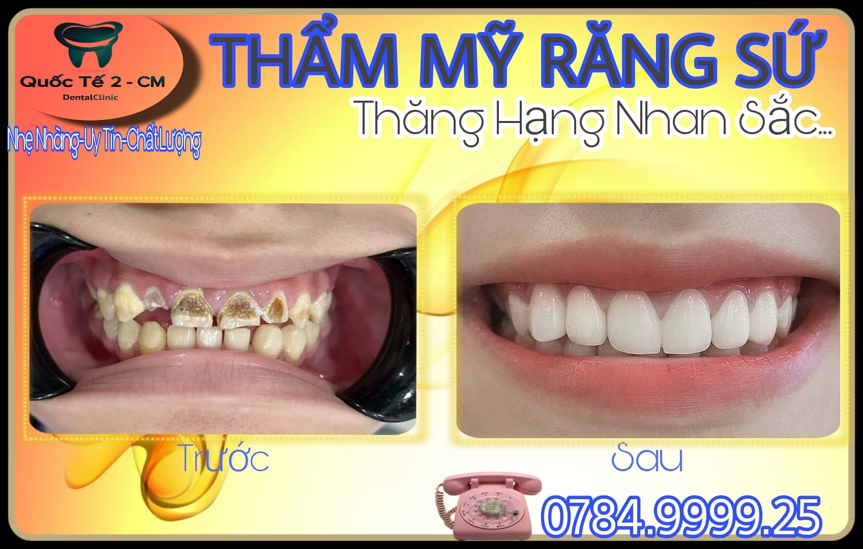 Nha Khoa Quốc Tế 2 - CM ảnh 2