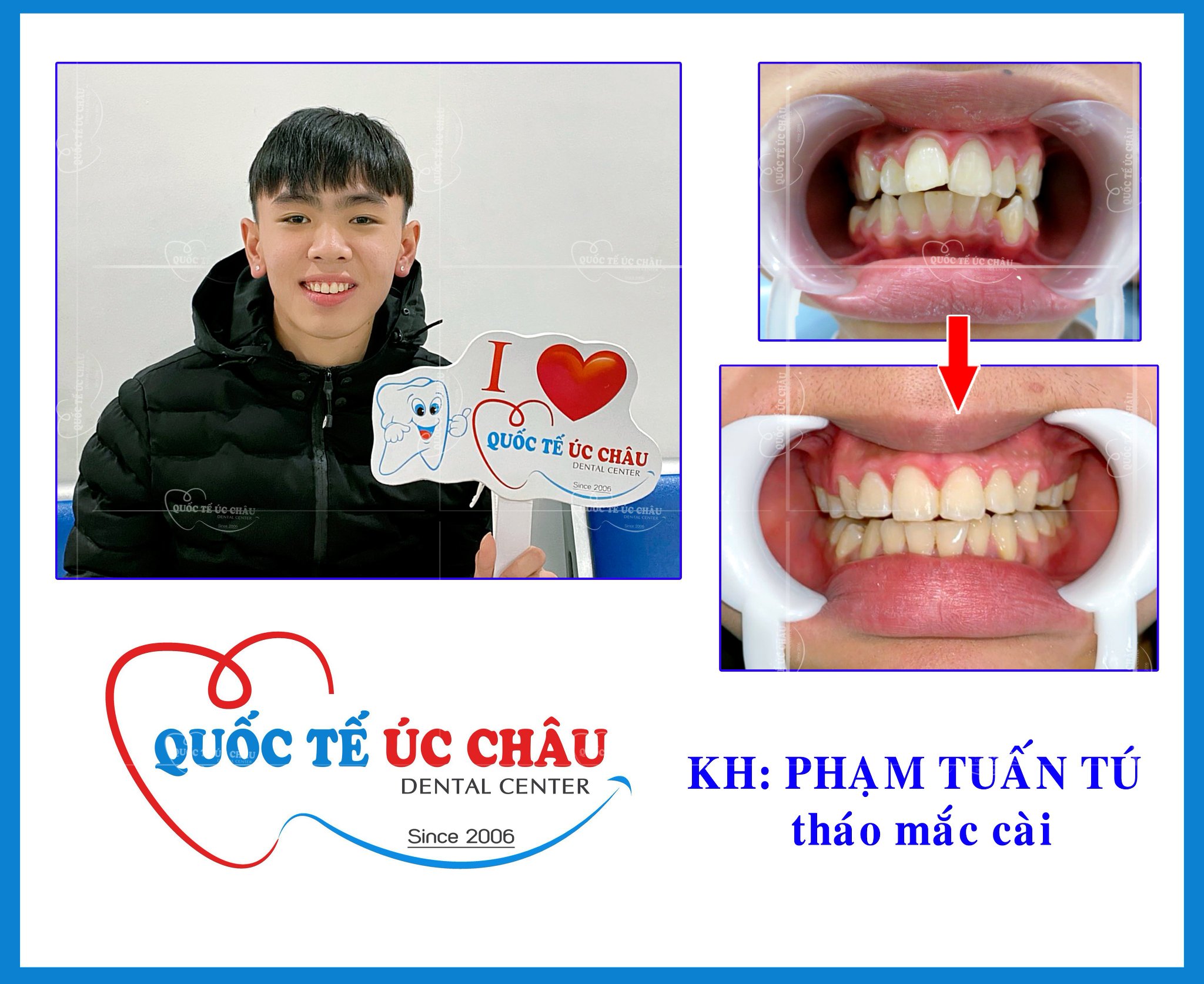 Nha Khoa Quốc Tế Úc Châu ảnh 3