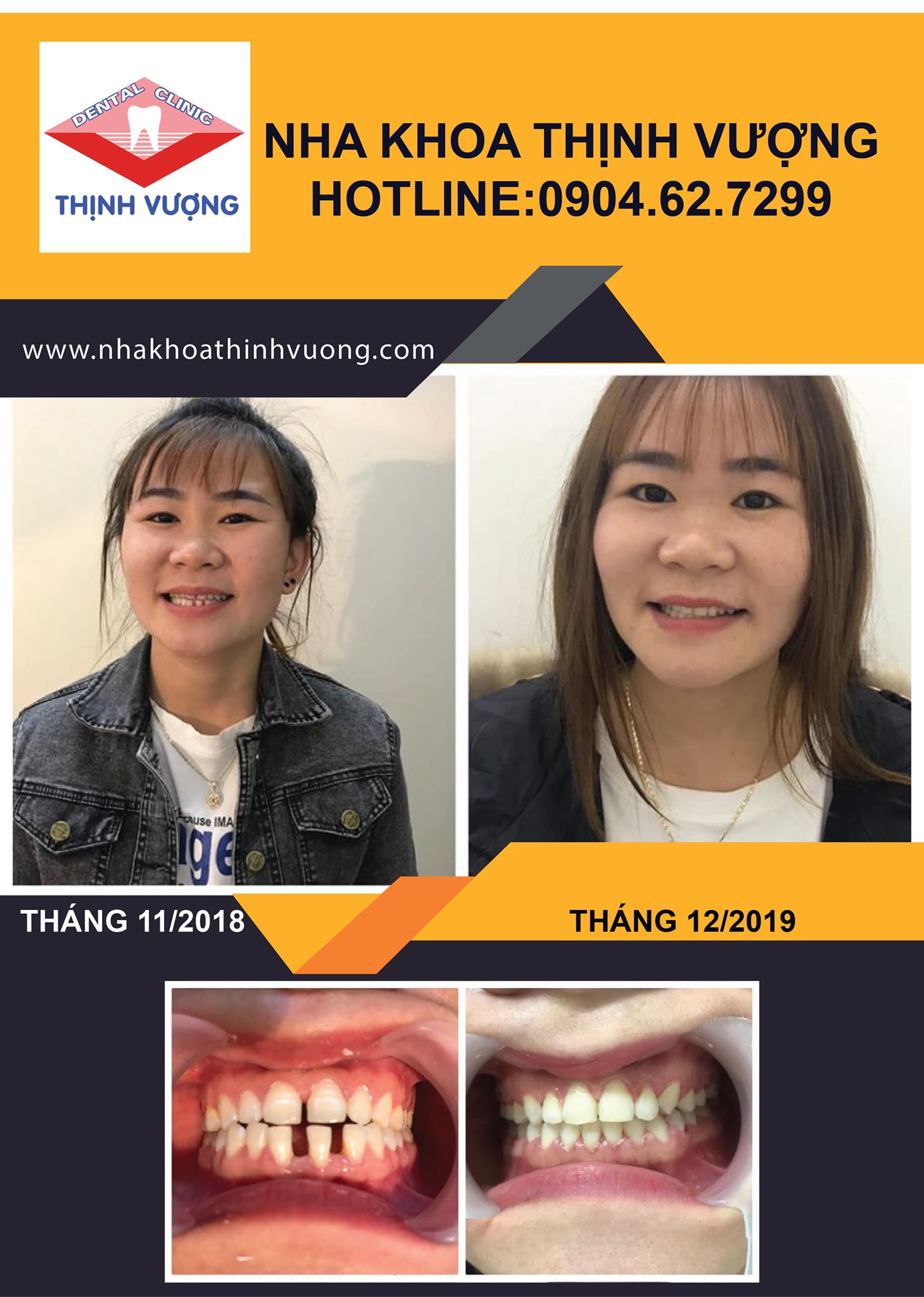 Nha Khoa Thịnh Vượng ảnh 2