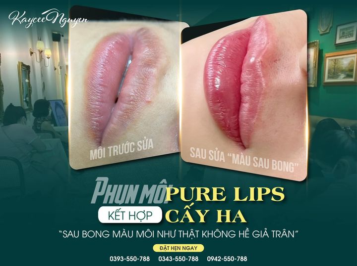 Thẩm Mỹ Kaycee Nguyen ảnh 2