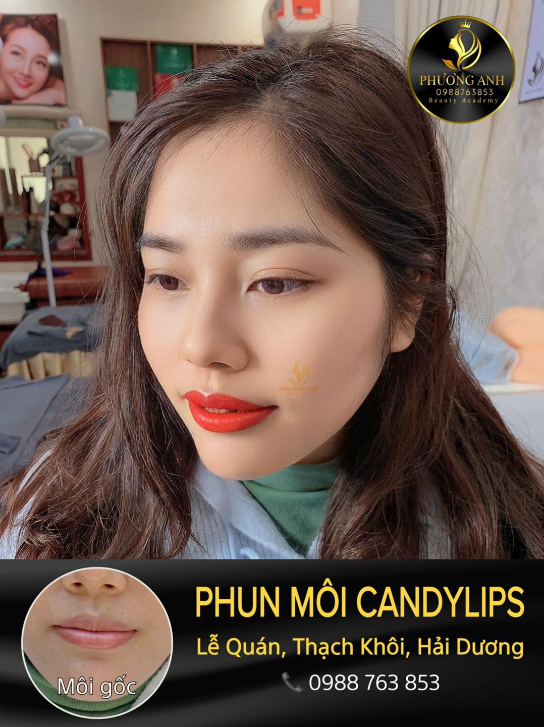 Thẩm Mỹ Phương Anh ảnh 1