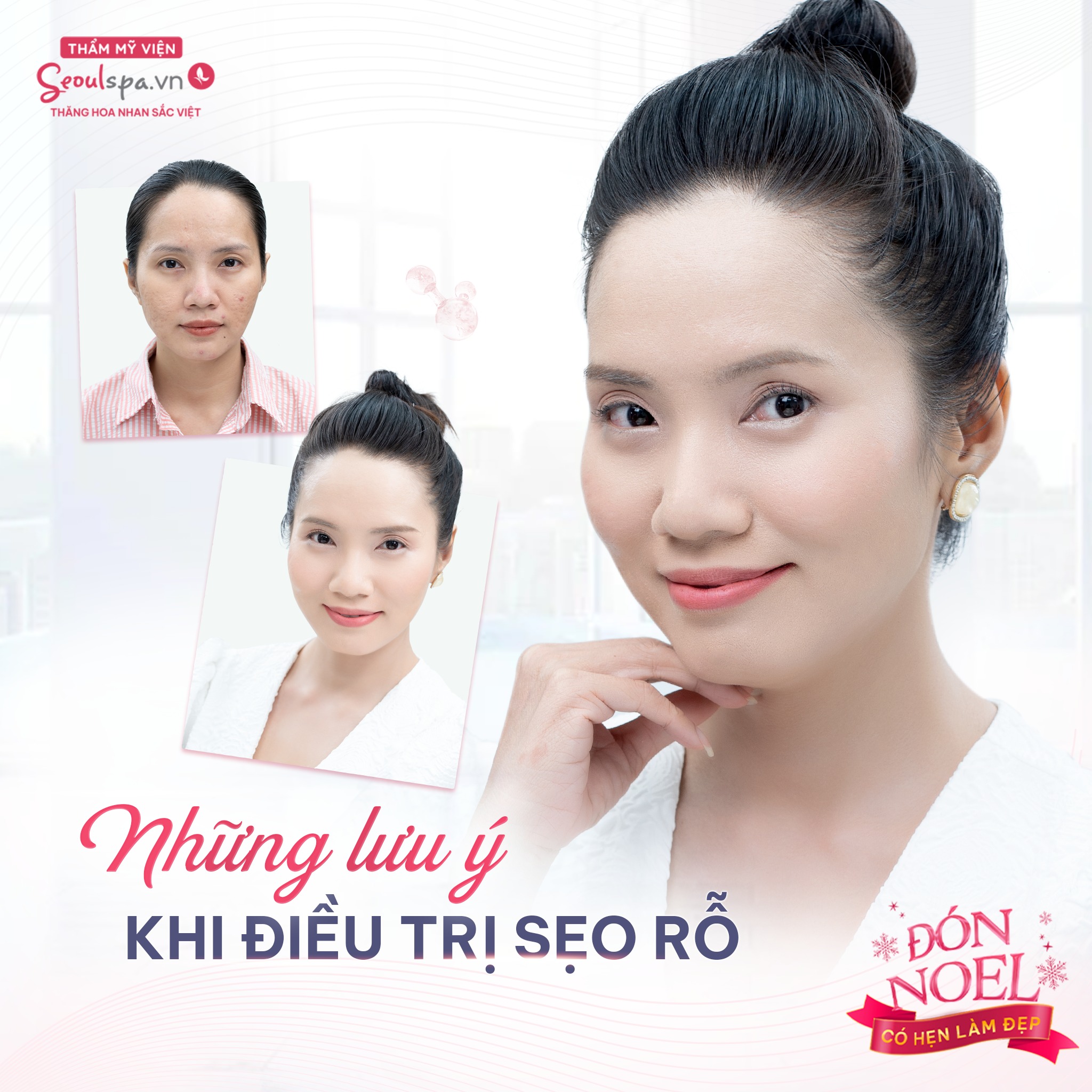 Thẩm Mỹ Viện SeoulSpa.Vn ảnh 2