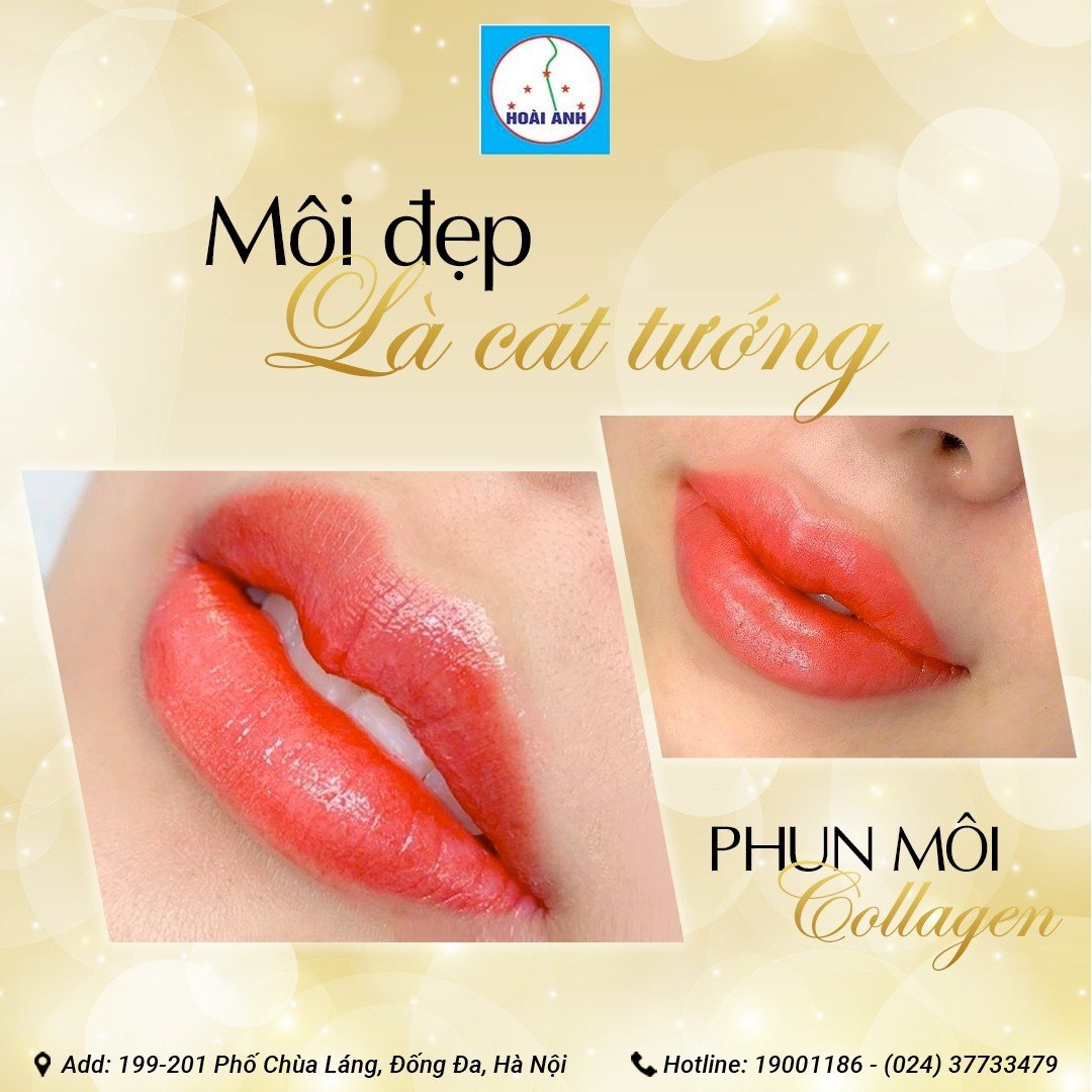 Thẩm mỹ viện Hoài Anh ảnh 1