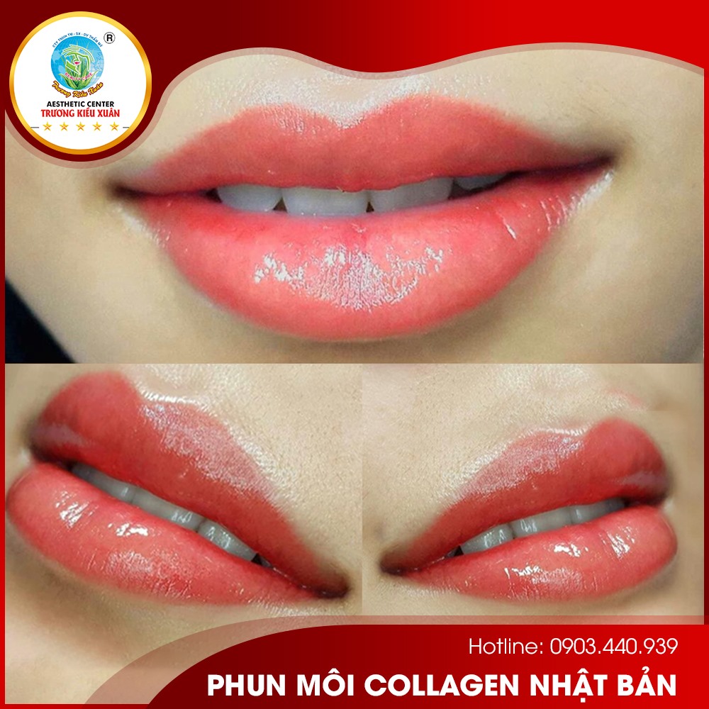 Thẩm mỹ viện Trương Kiều Xuân ảnh 2