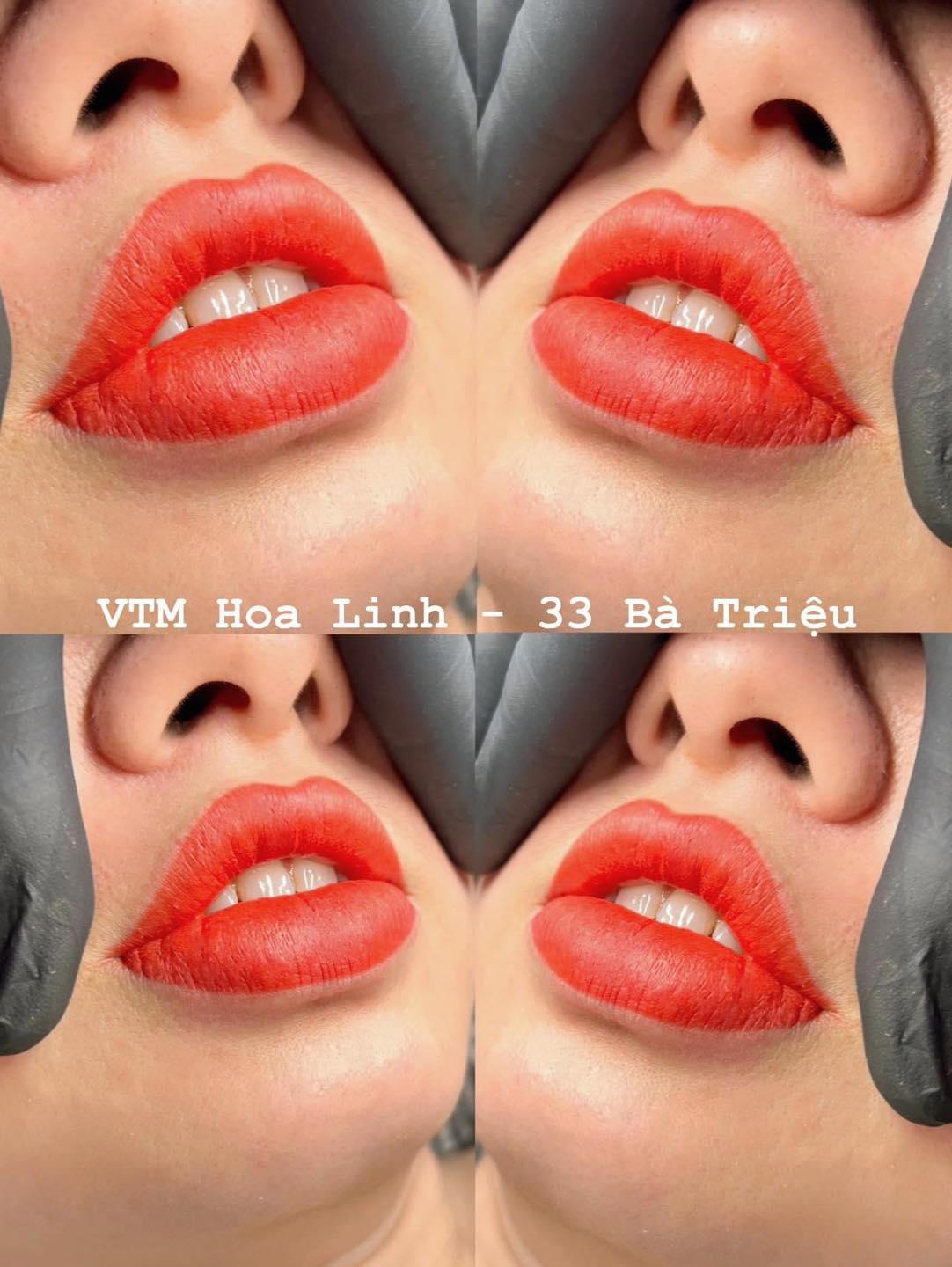 Viện Thẩm Mỹ Hoa Linh Beauty ảnh 1