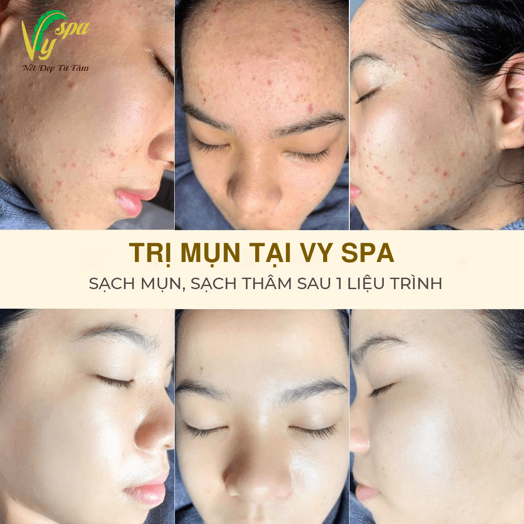 Vy Spa ảnh 1