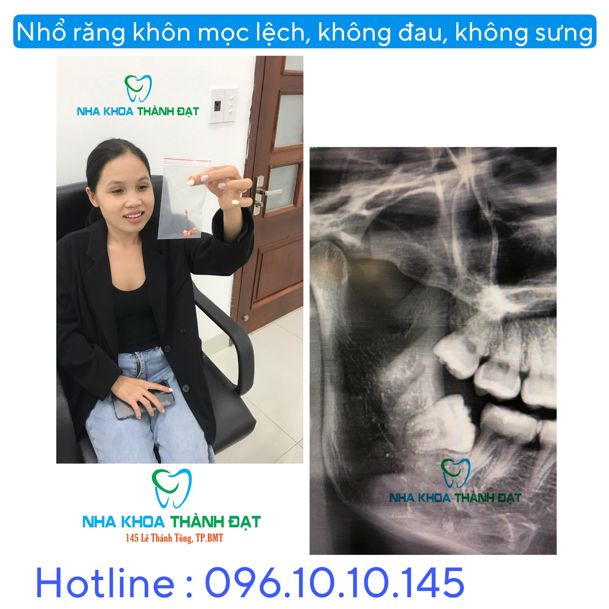 Nha Khoa Thành Đạt ảnh 1