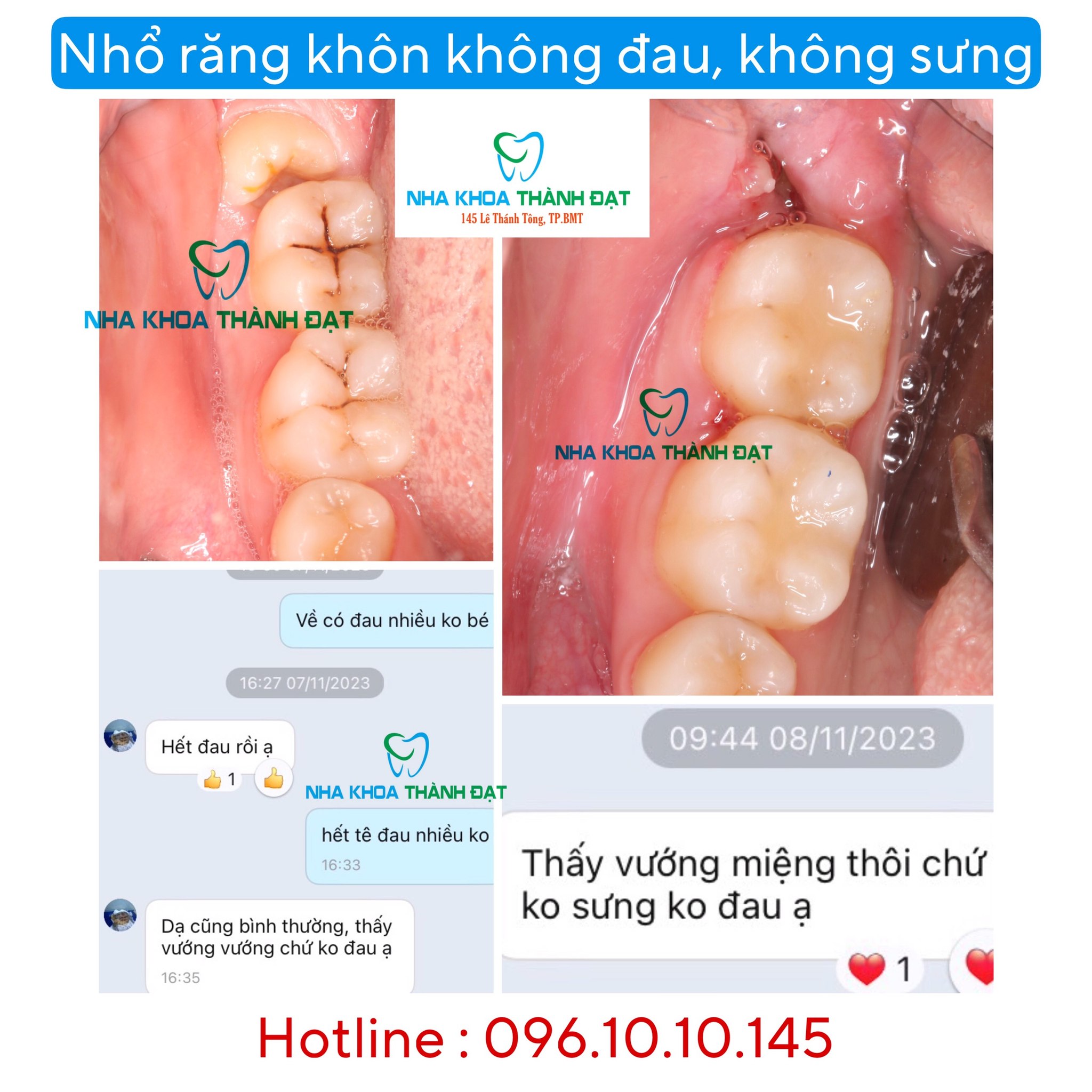 Nha Khoa Thành Đạt ảnh 2