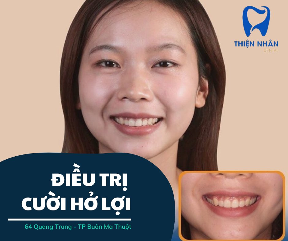 Nha Khoa Thiện Nhân ảnh 2