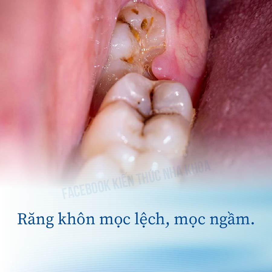 Nha Khoa Thiện Nhân ảnh 1