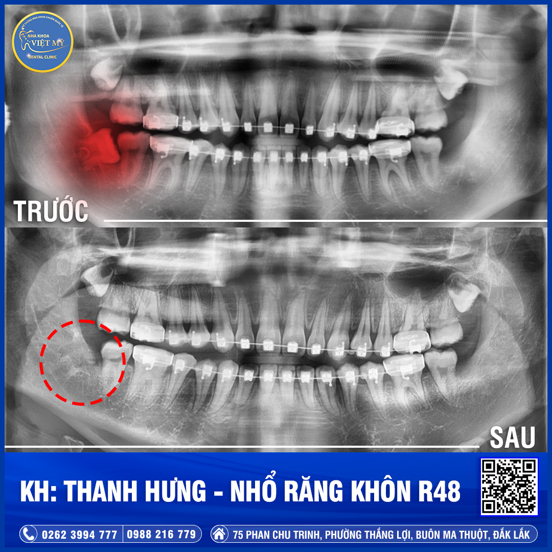 Nha khoa Việt Mỹ ảnh 2