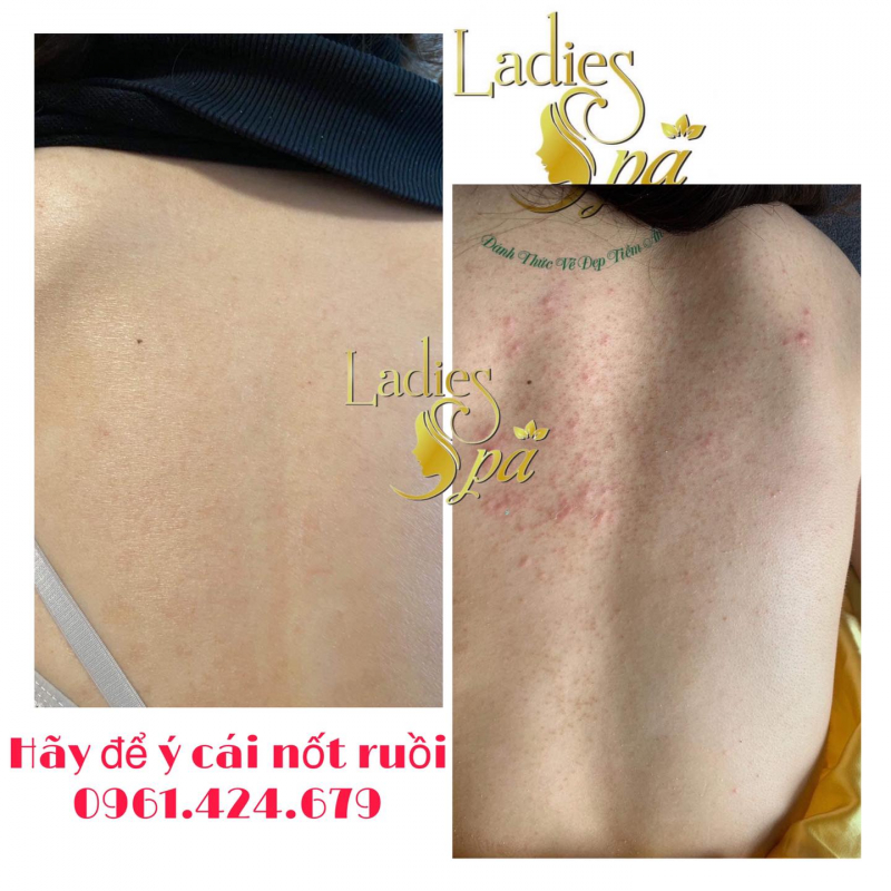 Ladies Spa ảnh 2