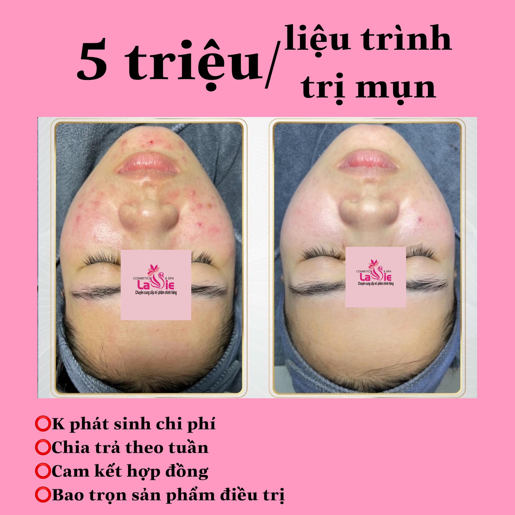 Lavie Spa ảnh 1