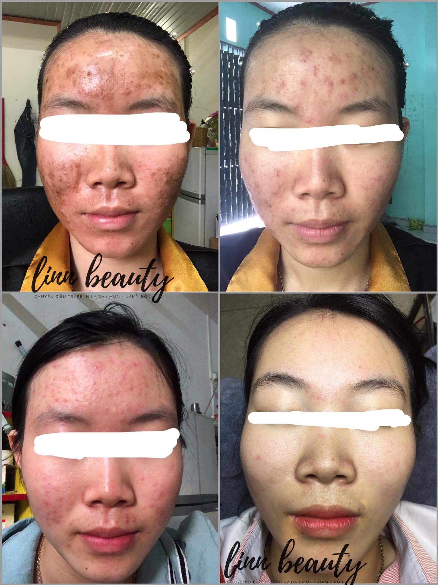 Linn Spa Beauty KonTum ảnh 2