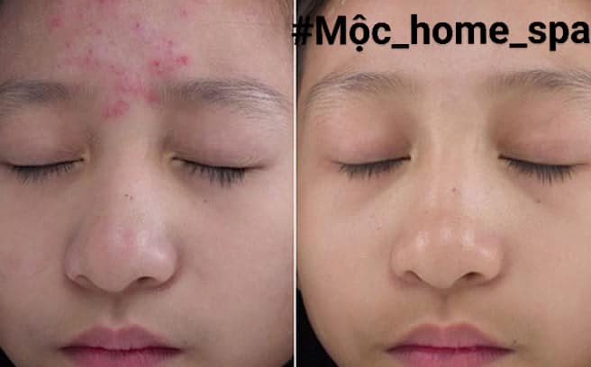 Mộc home spa ảnh 1