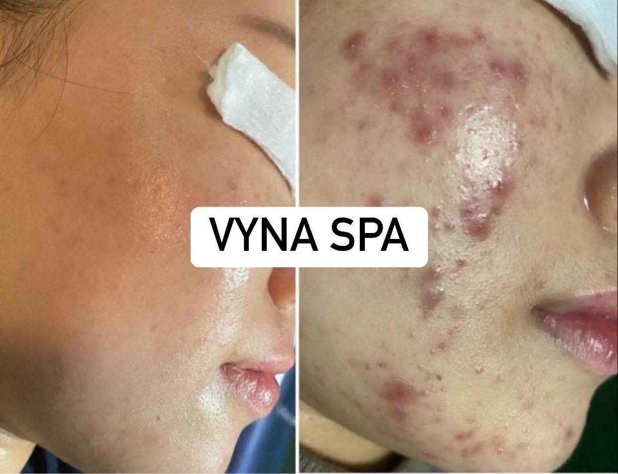 VyNa Spa ảnh 2