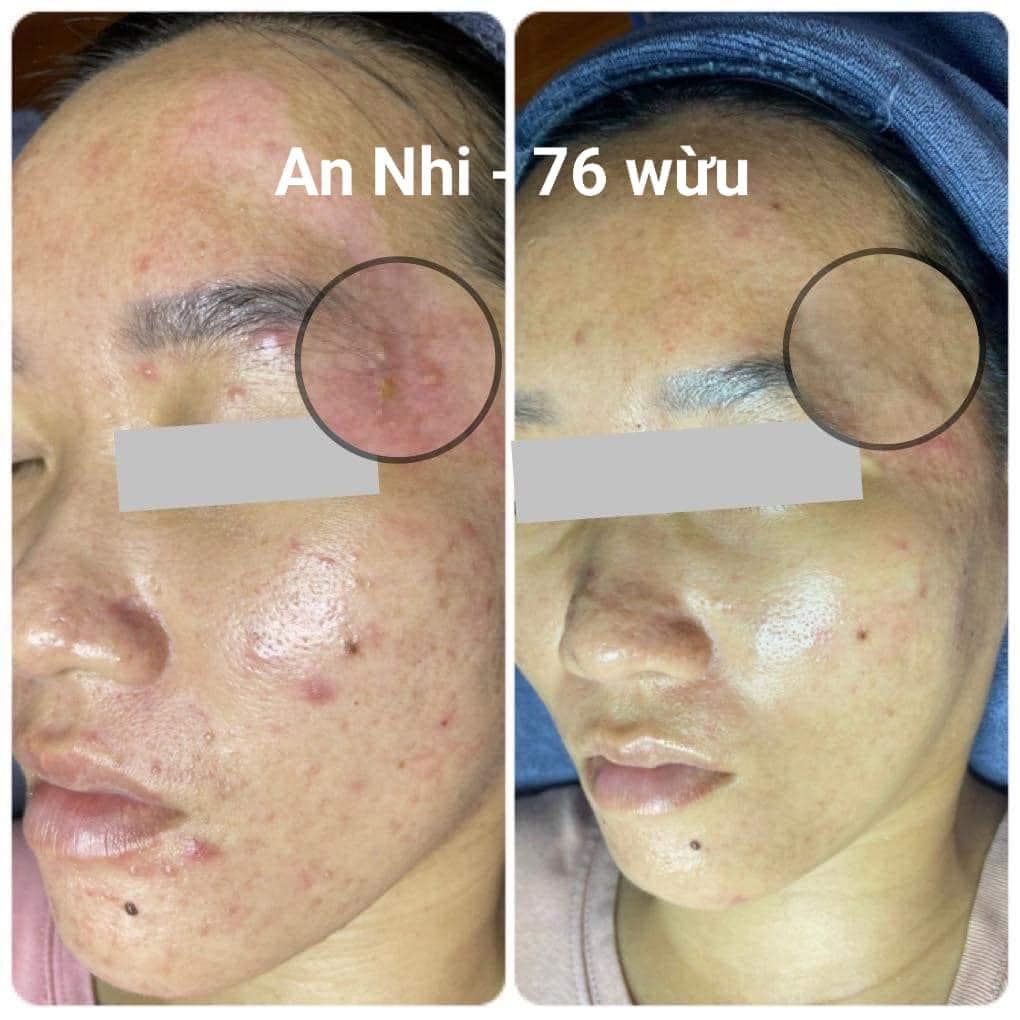 AN NHI SPA ảnh 1