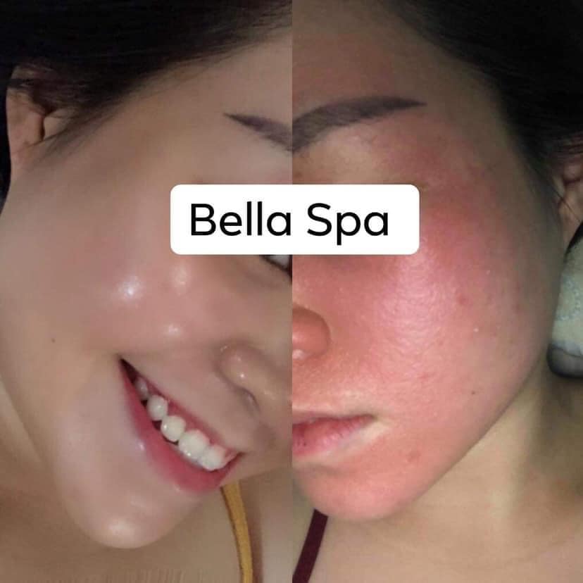 Bella Spa ảnh 3