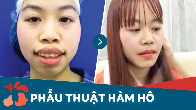 Bệnh viện thẩm mỹ Kangnam ảnh 2