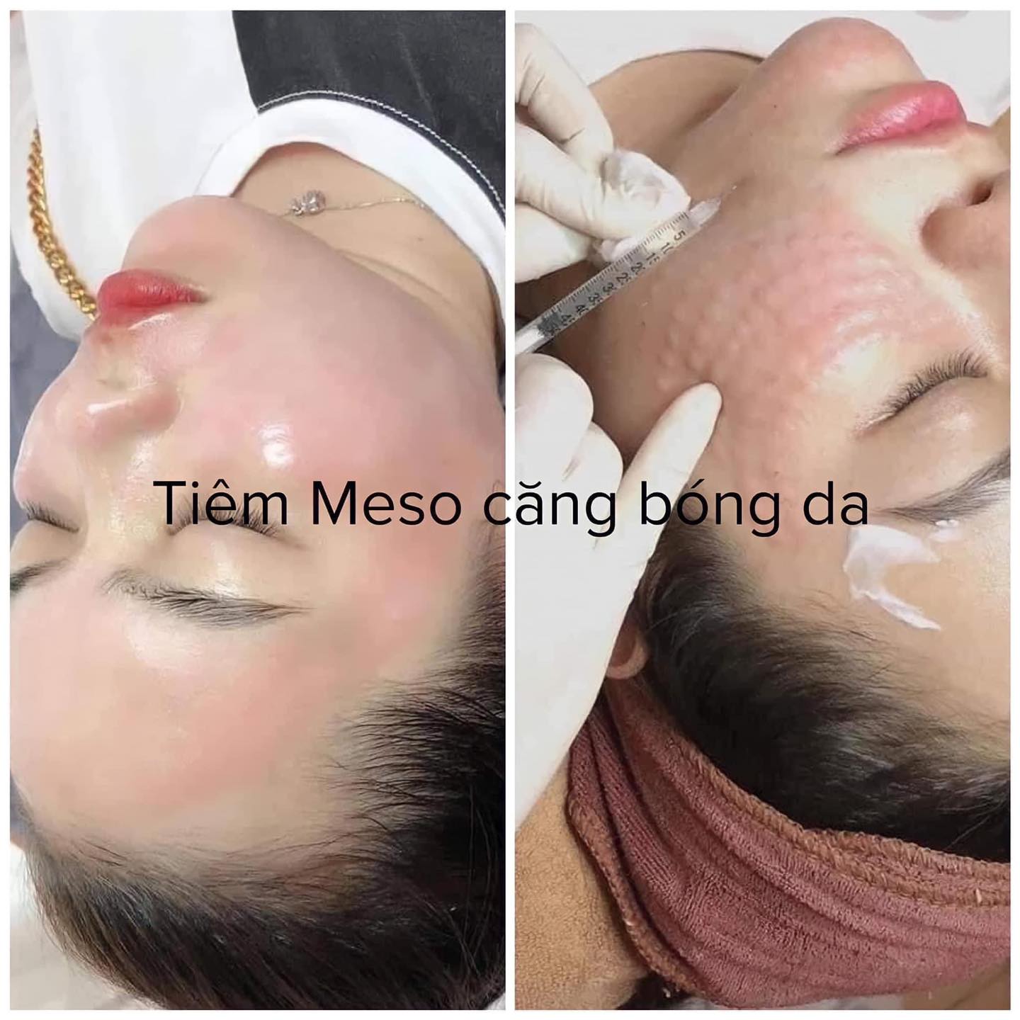 Hana Spa - Dưỡng Sinh Đông Y ảnh 2