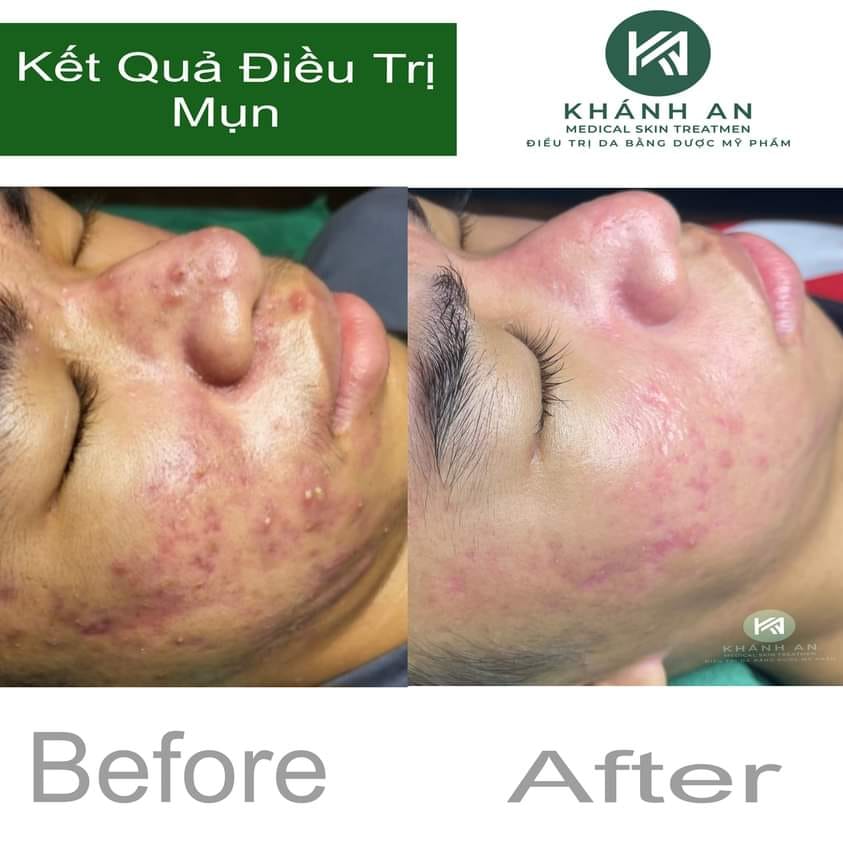 Khánh An Spa ảnh 2