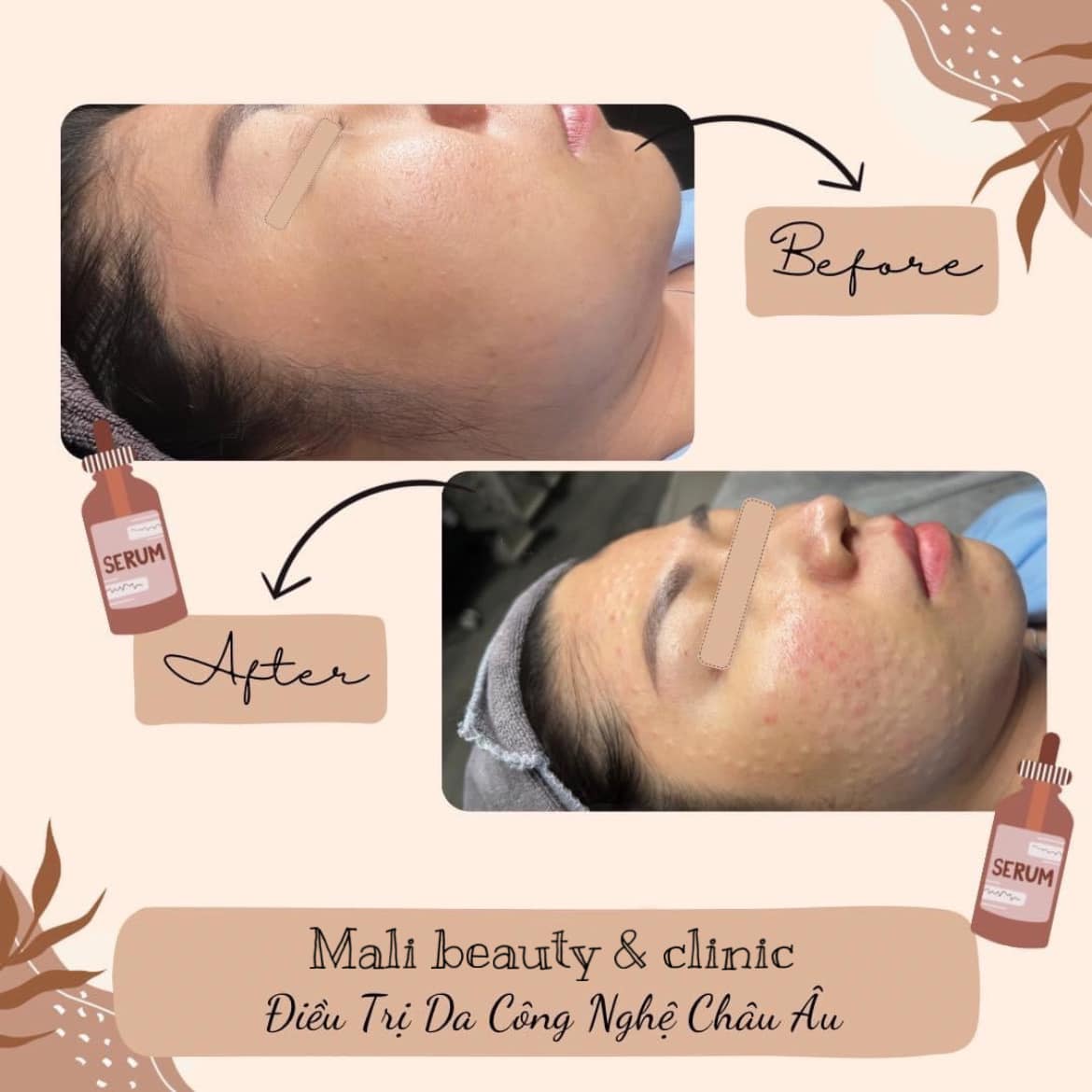 MaLi Beauty Spa Clinic ảnh 1