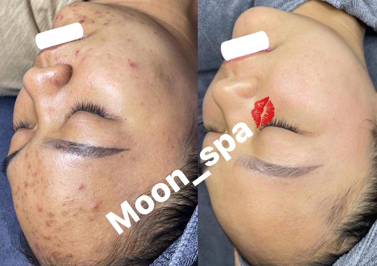 Moon Spa Beauty Center ảnh 2