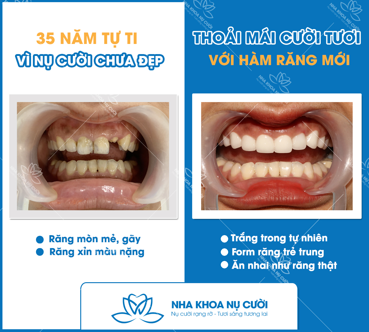 Nha Khoa Nụ Cười ảnh 2