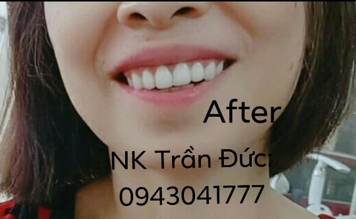 Nha Khoa Trần Đức ảnh 2