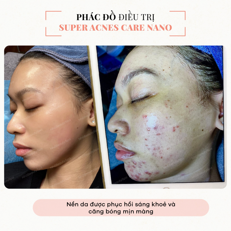 Nhỏ Beauty Spa ảnh 2