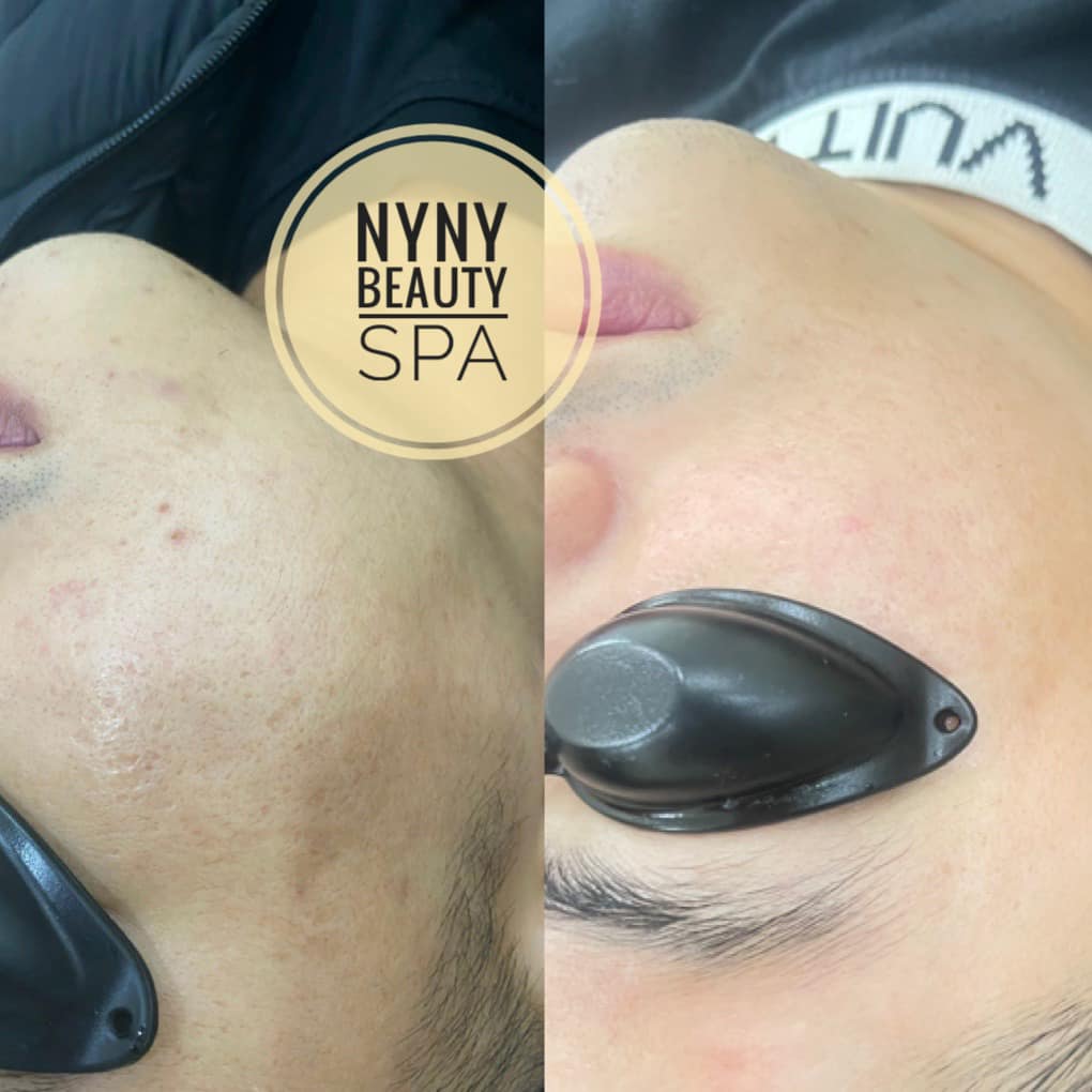 NyNy Beauty Spa ảnh 2