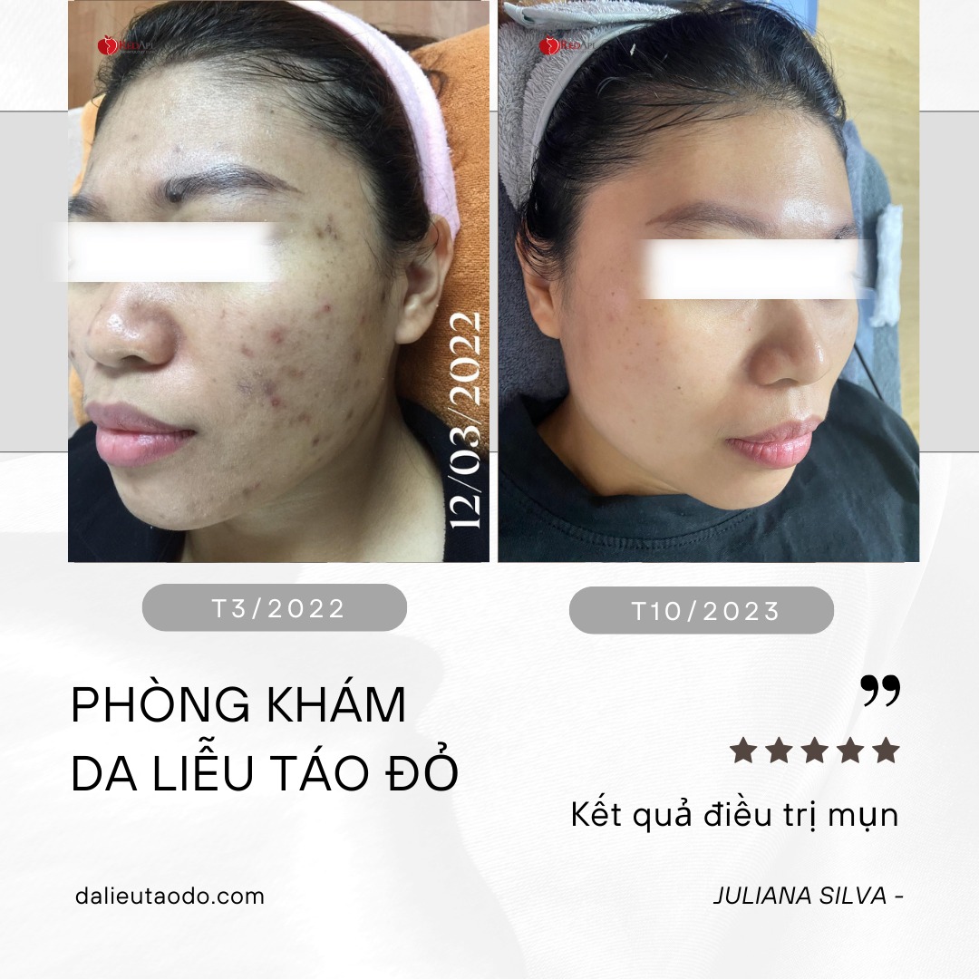 PHÒNG KHÁM CHUYÊN KHOA DA LIỄU TÁO ĐỎ ảnh 2