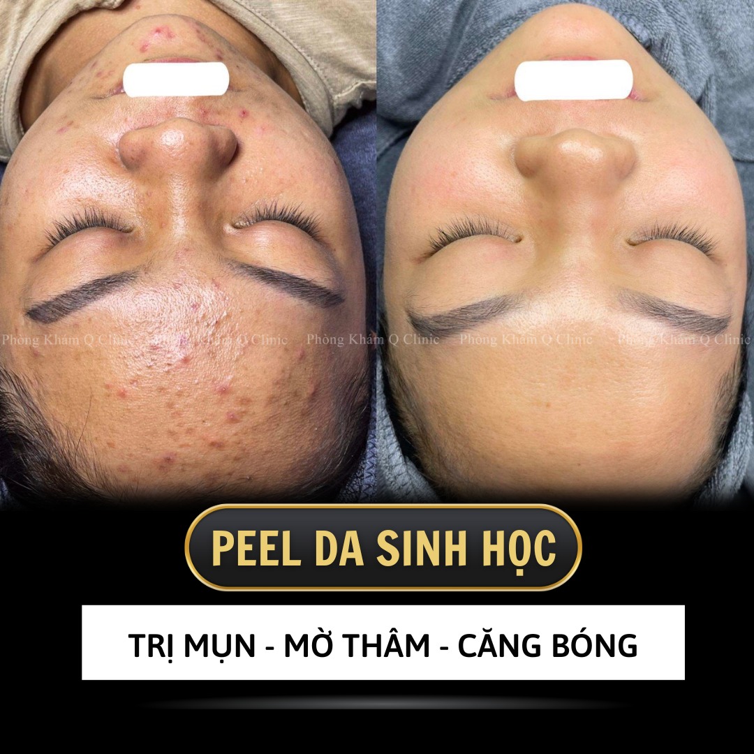 Phòng Khám Da Liễu Q Clinic ảnh 1