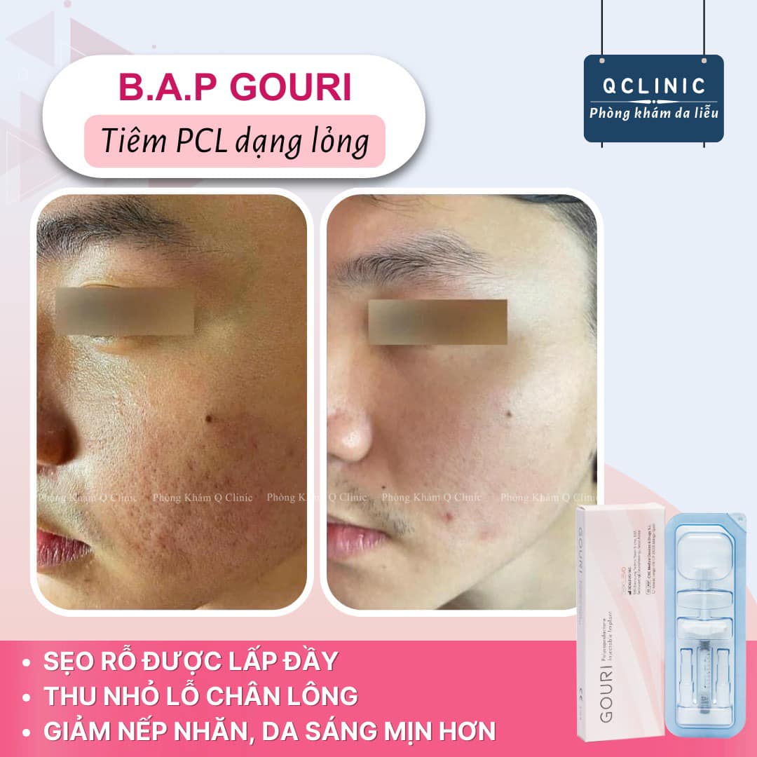 Phòng Khám Da Liễu Q Clinic ảnh 2