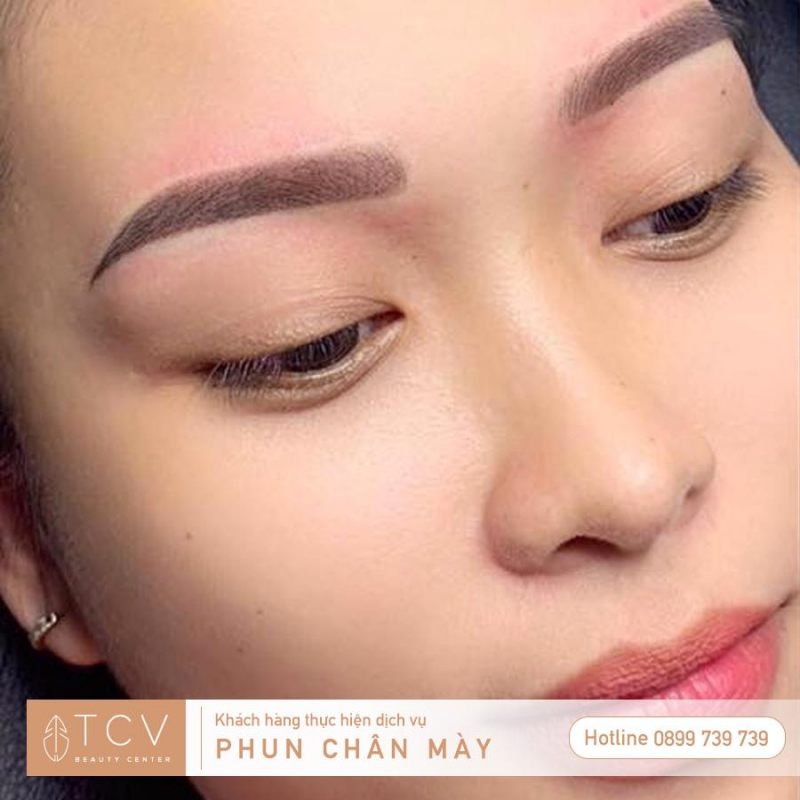 TCV Beauty Center ảnh 1