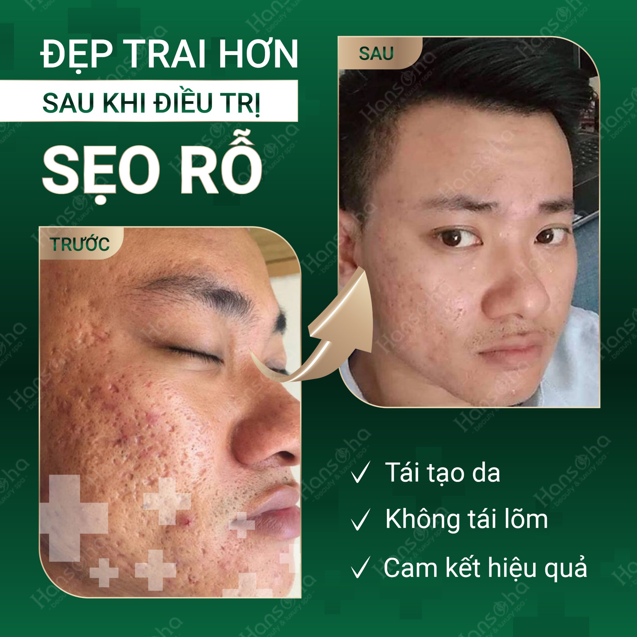 Thẩm Mỹ Quốc Tế Hansoha ảnh 2